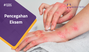 Read more about the article Pencegahan Eksem