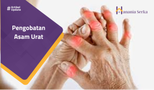 Read more about the article Pengobatan Asam Urat