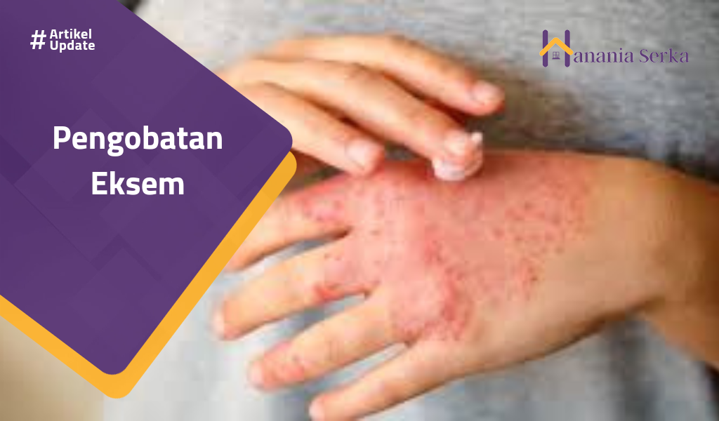 You are currently viewing Pengobatan Eksem