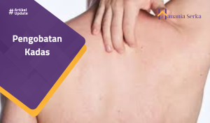 Read more about the article Pengobatan Kadas