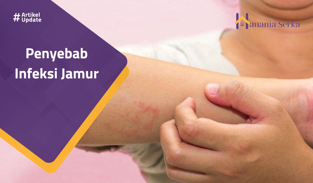 Read more about the article Penyebab Infeksi Jamur