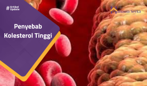 Read more about the article Penyebab Kolesterol Tinggi