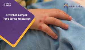 Read more about the article Penyebab Campak Yang Sering Terabaikan